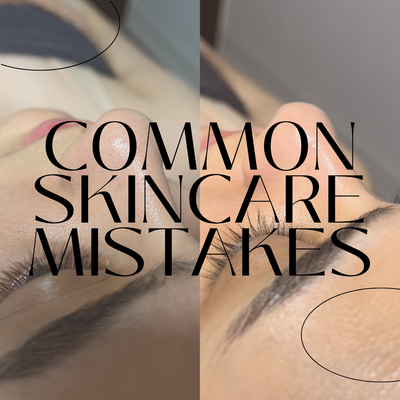 Common Skincare Mistakes: How to Avoid Them for a Healthy Glow